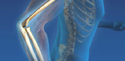 Muskuloskeletal