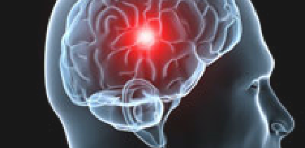 Neurological